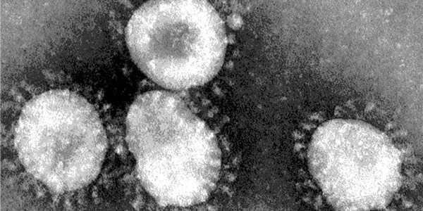 121 cases tested, still no coronavirus in SA - NICD | News Article