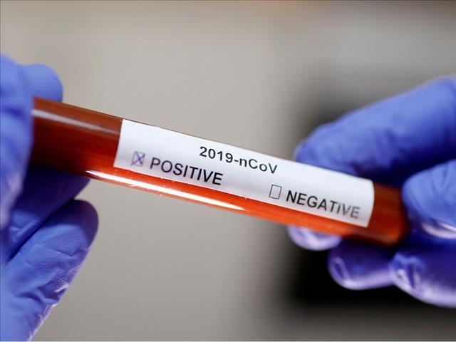 Little known about FS #coronavirus case | News Article