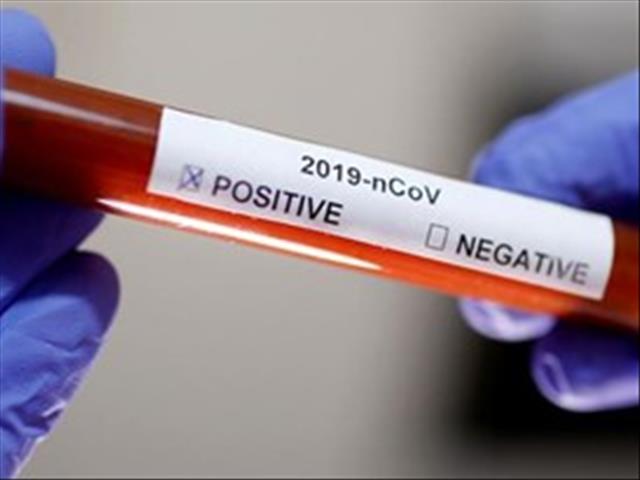 Tref voorsorg teen #koronavirus, vra Agri SA | News Article