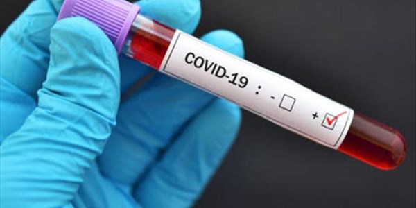 #BreakingNews: #CoronavirusSA hits 240 mark | News Article