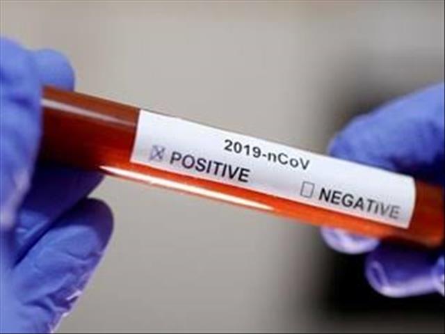FDA authorises new 45-minute #Coronavirus test | News Article