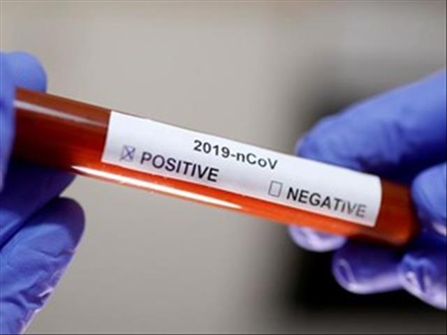 #BreakingNews #CoronavirusSA now reported in all provinces | News Article