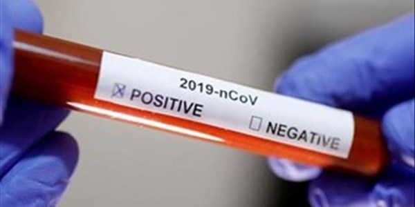 #CoronavirusSA: Two patients in ICU #CoronavirusSA: Two patients in ICU | News Article