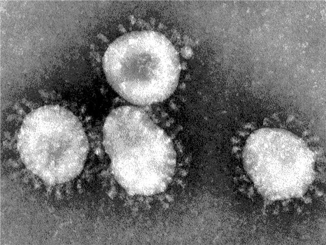 Expect more #COVID-19 cases - Mkhize | News Article