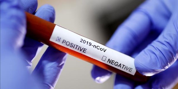 FS records 49 #Coronavirus cases FS records 49 #Coronavirus cases | News Article