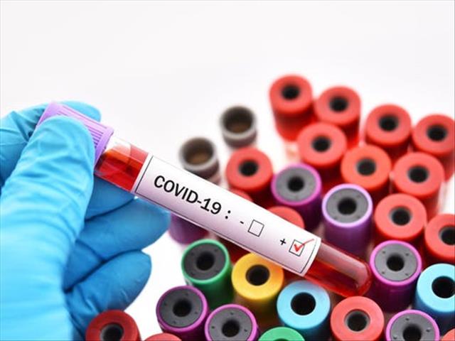 #CoronavirusSA: NW patient out of ICU | News Article
