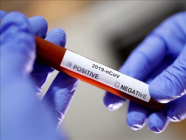 #Covid19 cases in SA rise to 4546 | News Article