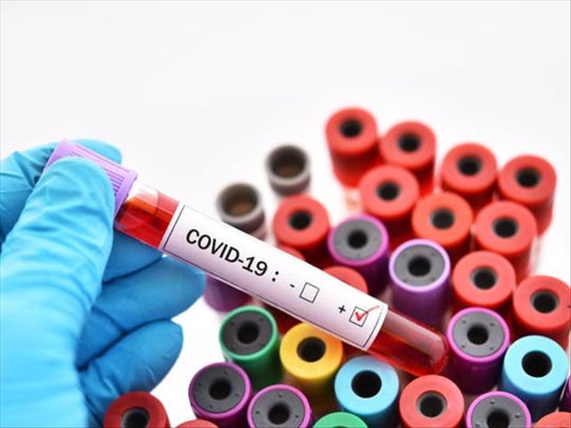 #Covid19: Several quarantined after Bfn Clover employee tests positive | News Article