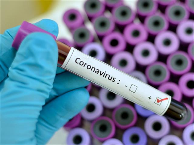 #CoronavirusNW: Mahikeng hospital staff receive test results | News Article