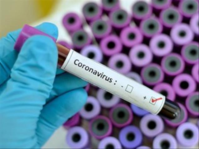 #CoronavirusNC: NICD consulted over unallocated results  | News Article