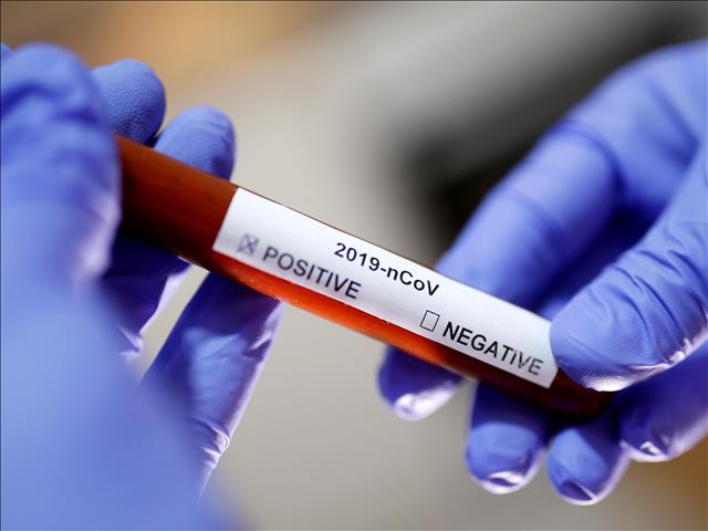 #COVID19 cases in SA pass 70,000 | News Article
