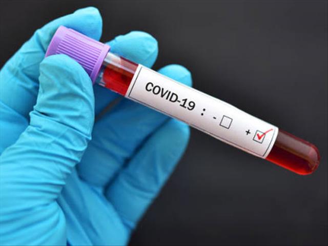 #SchoolsReopening: NW school closes after #Covid19 case | News Article
