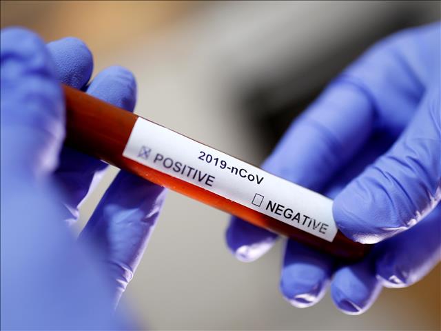 China reports 28 new #Coronavirus cases  | News Article
