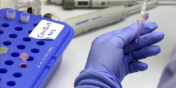 #Coronavirus focuses attention on TB in SA prisons #Coronavirus focuses attention on TB in SA prisons | News Article