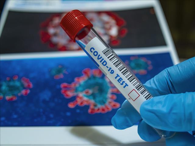 Truck carrying #Covid19 specimens hijacked | News Article