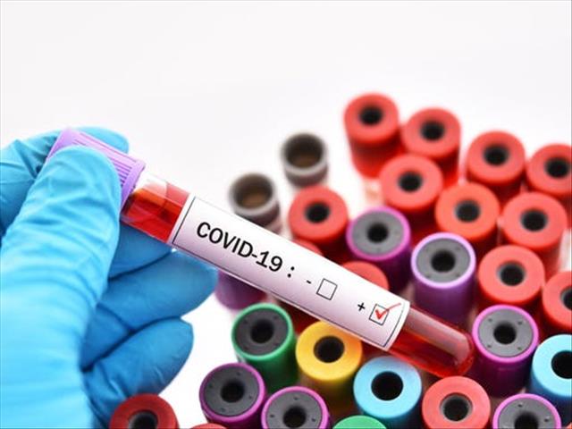 #Coronavirus cases surge at FS mine | News Article