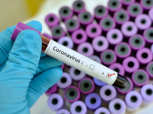 #CoronavirusNW: Death toll surpasses 80 | News Article