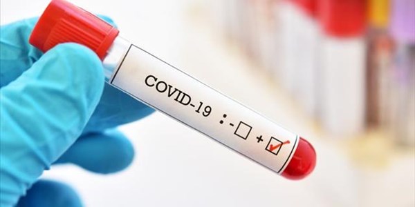 #CoronavirusFS deaths approach 500 | News Article