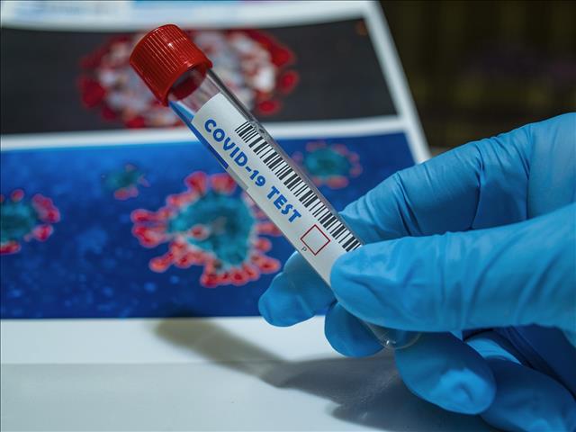 #Covid19: SA infections exceed 500,000 | News Article