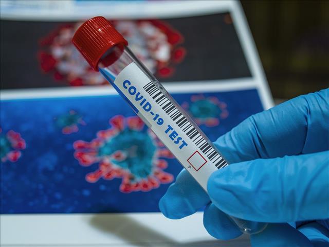 #CoronavirusNW: Sixteen more patients die | News Article