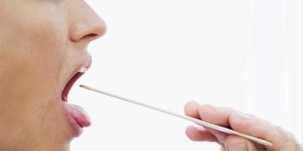 #OralHealthMonth - Cancer of the tongue is serious and on the increase | News Article
