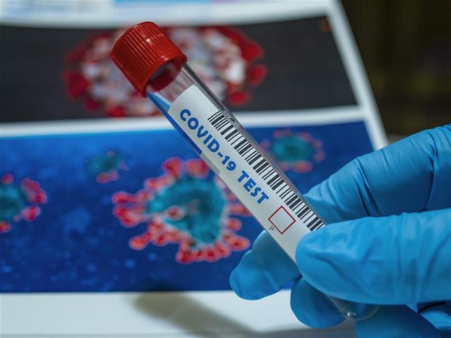 #CoronavirusSA: 81 deaths recorded | News Article