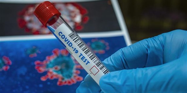 #CoronavirusFS: Eight markers positive | News Article