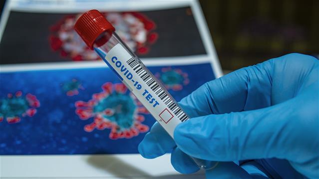 NC reports 137 new #Covid19 cases | News Article