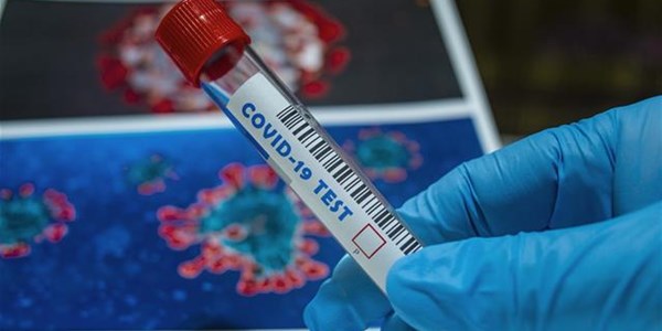 #CoronavirusNW: 13 markers tested positive #CoronavirusNW: 13 markers tested positive | News Article