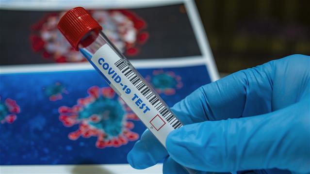 #Covid19: Hundreds at Lesotho border test positive | News Article