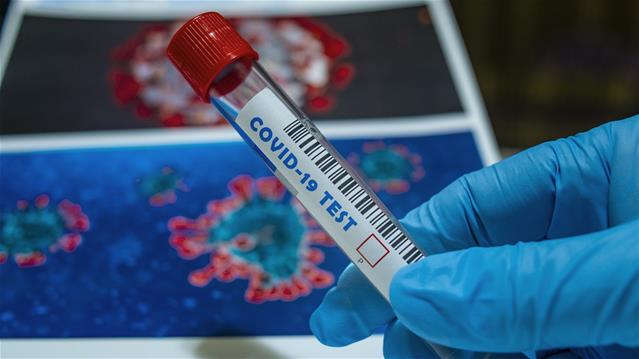 SA’s #Covid19 cases breach 1.5m mark | News Article