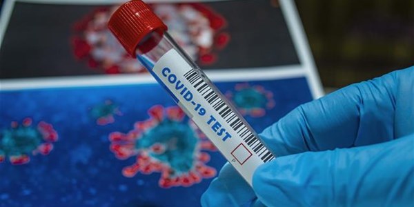 #CoronavirusSA: 110 deaths reported  | News Article
