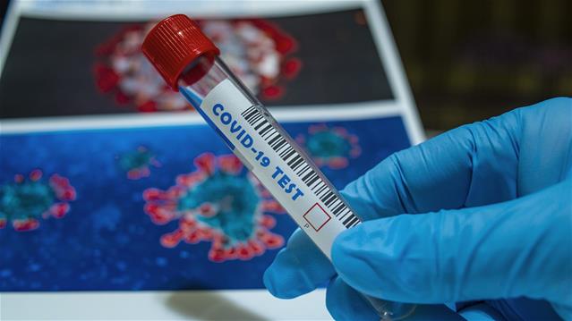 More than 300 new #Covid19 related deaths recorded | News Article