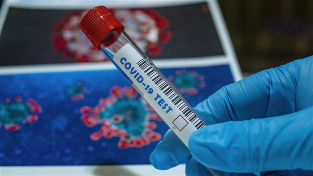#Covid19: 1 051 new cases, 29 new deaths | News Article