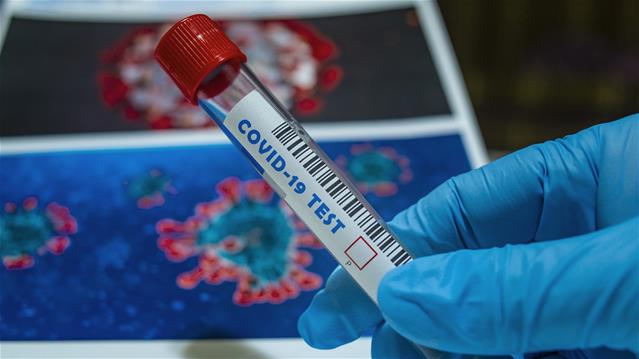 #Covid19: 1 227 new cases, 81 more deaths | News Article