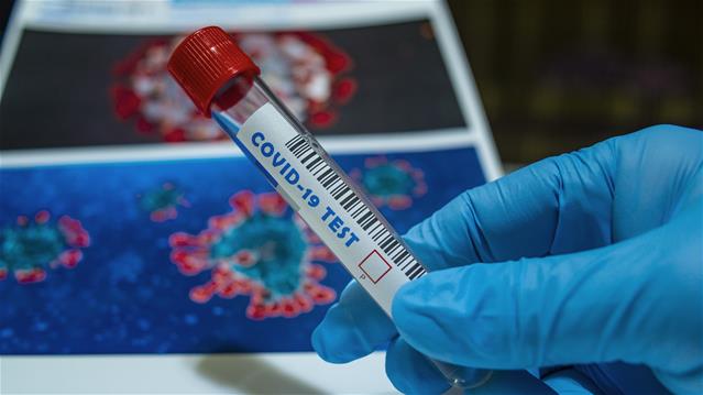 #Covid19: 1,424 new cases, 92 more deaths | News Article