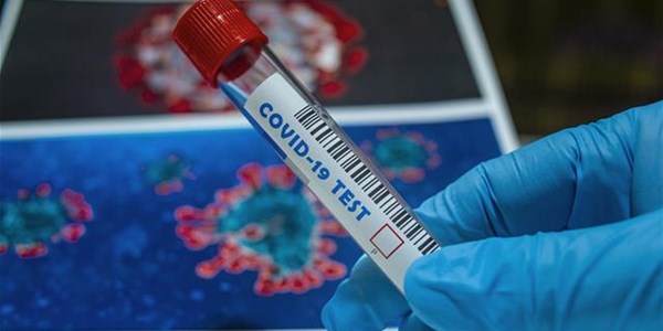 SA records 1 273 new #Covid19 cases SA records 1 273 new #Covid19 cases | News Article
