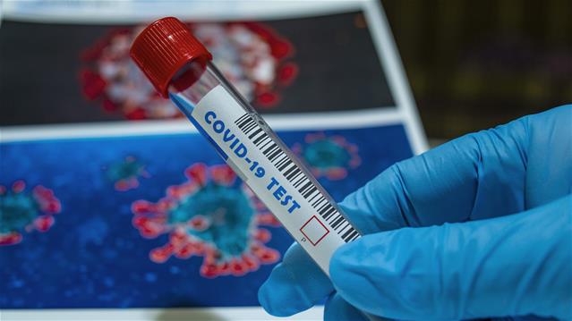 SA’s #Covid19 death rate now at 52 954 | News Article