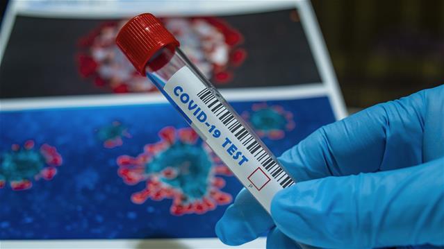 1 240 new #Covid19 cases reported | News Article