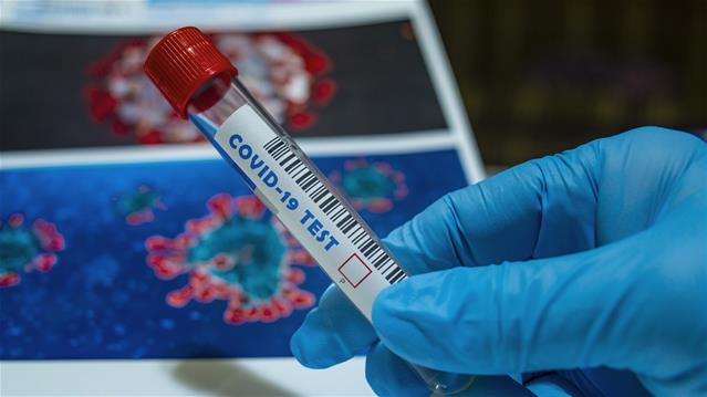 #Covid19: 1,366 new cases, 62 more deaths | News Article