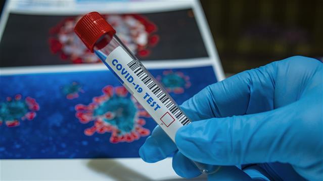 SA’s #Covid19 cases climb by 3000 for a second day | News Article