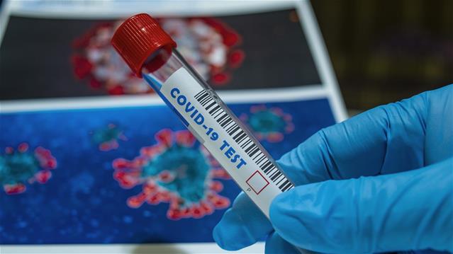 #Covid19: SA reports 2 750 new cases  | News Article