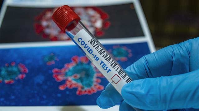 #CoronavirusSA: 1,674 new cases recorded | News Article
