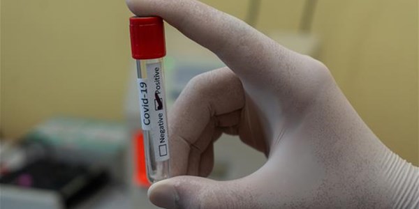 'SA to reach herd immunity in ten years at current vaccination pace' 'SA to reach herd immunity in ten years at current vaccination pace' | News Article