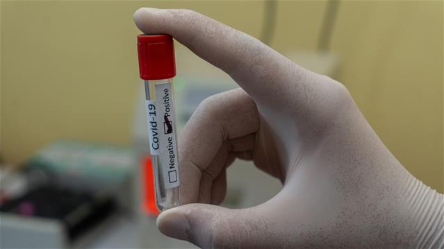 #Covid19: 'Young people being infected more this time around' | News Article
