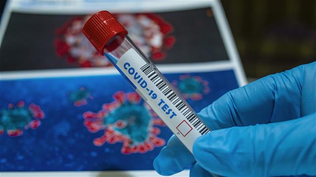 3,614 new #Covid19 cases recorded | News Article